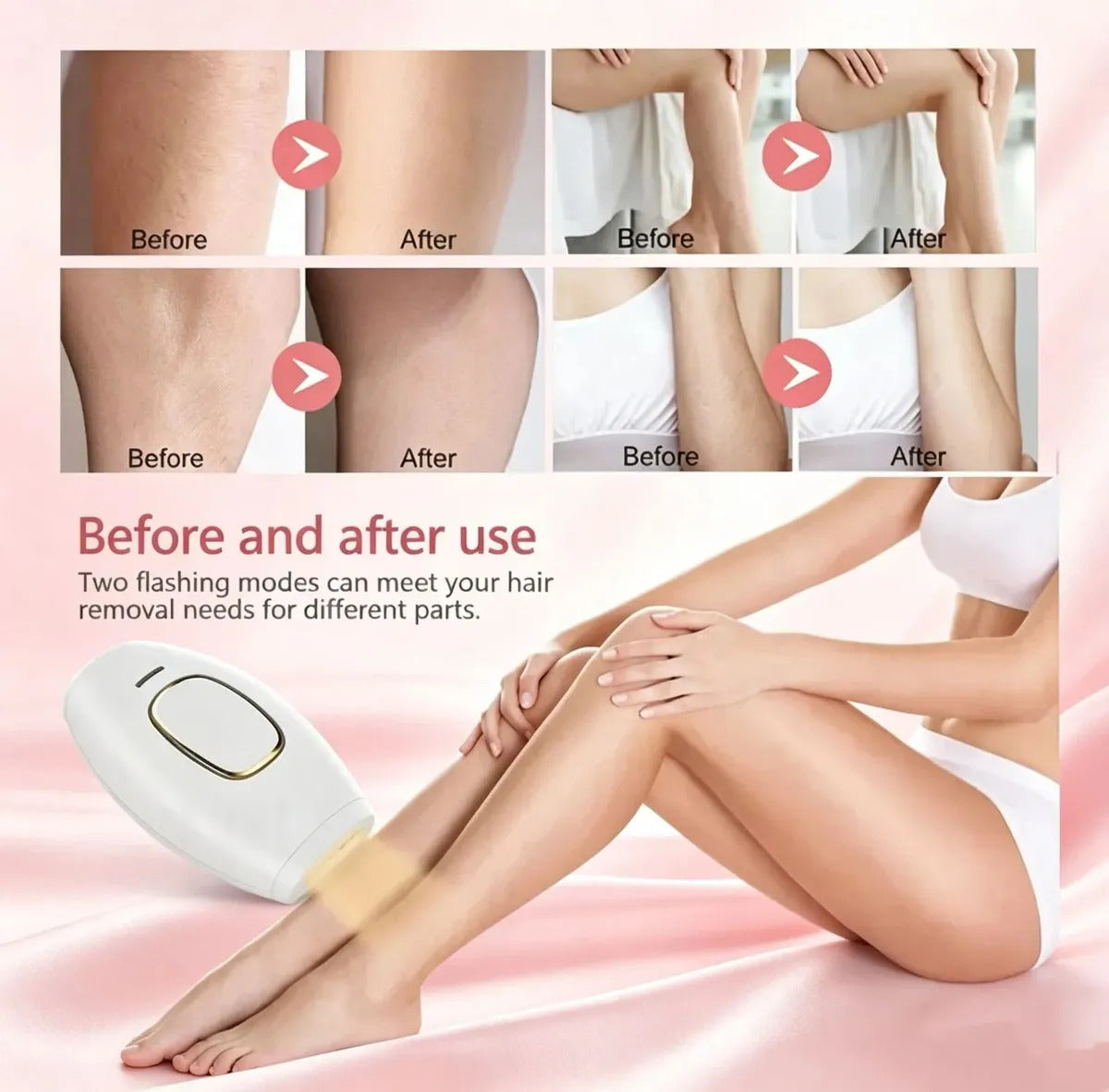 Depilador a Laser IPL 900.000 Flashes - LumiSkin®