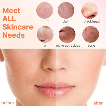 Escova de Limpeza Facial 3 em 1 - PureSkin®